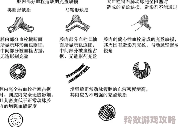 英雄联盟手游枪影识英雄活动答案揭秘：全面解析问题及推荐答案指南